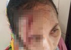 Saksi Tidak Mau Bersumpah Memberikan Kesaksian Palsu "Ada Apa Dengan PN Lubuk Pakam Kab. Deli Serdang Yusniar Mengalami Penganiayaan Saksi Yang Hadir Memberikan Kesaksian Palsu